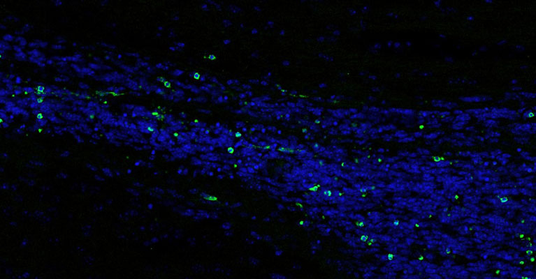 brain-guardians-remove-dying-neurons