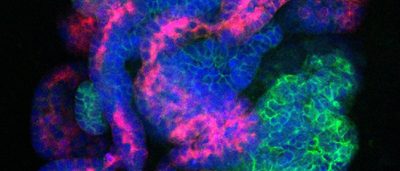 new-method-creates-endless-supply-kidney-precursor-cells