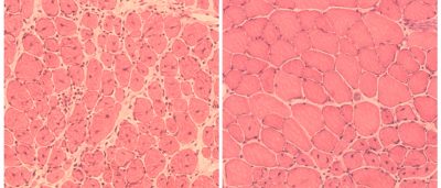 turning-back-time-salk-scientists-reverse-signs-aging
