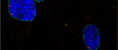 heart-disease-leukemia-linked-dysfunction-nucleus