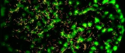 immune-receptors-amplify-invader-signals-turning-mini-machines