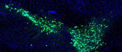 hard-choices-ask-brains-dopamine