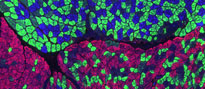 research-confirms-nerve-cells-made-skin-cells-valid-lab-model-studying-disease-2