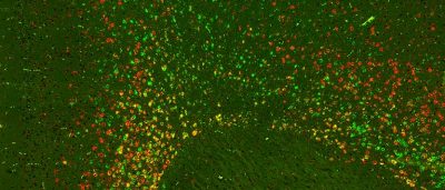 new-kinds-brain-cells-revealed