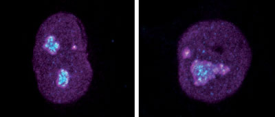 protein-turnover-may-useful-marker-aging