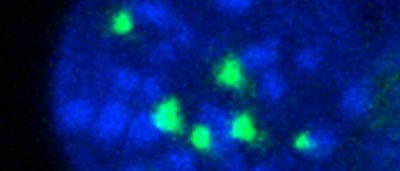 multifunctional-protein-contributes-blood-cell-development