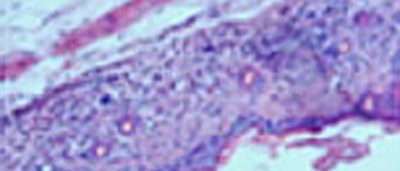 immune-cell-policing-offers-insights-cancer-autoimmune-disease