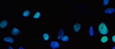salk-scientists-curb-growth-cancer-cells-blocking-access-nutrients