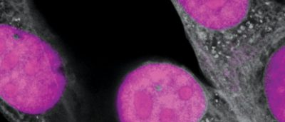 crispr-genetic-editing-takes-another-big-step-forward-targeting-rna