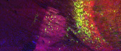 brain-cells-get-information-may-determine-roles-diseases
