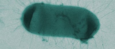 discovery-reveals-cells-try-control-levels-key-hiv-protein