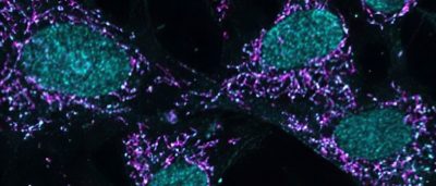 cells-agree-doesnt-kill-makes-stronger