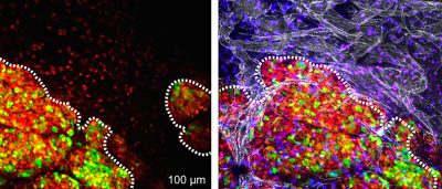 salk-scientists-shed-light-breast-cancer
