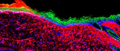 reprogramming-wound-cells-heals-large-ulcers-regenerates-skin