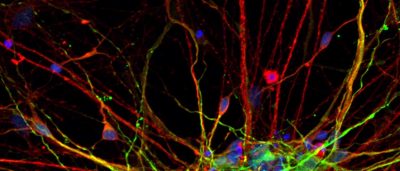 scientists-reveal-clues-early-development-autism-spectrum-disorder
