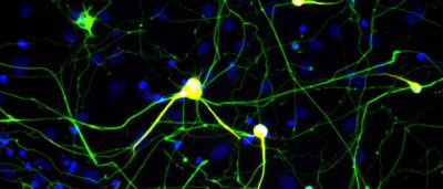 research-confirms-nerve-cells-made-skin-cells-valid-lab-model-studying-disease