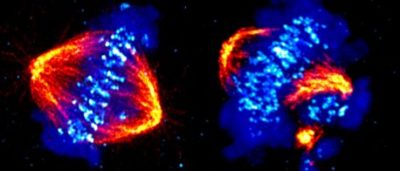 new-role-for-a-driver-of-metastatic-cancers