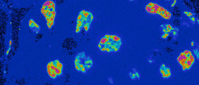 how-old-are-your-organs-to-scientists-surprise-organs-are-a-mix-of-young-and-old-cells
