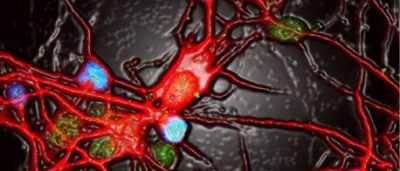 why-antidepressants-do-not-work-for-everyone