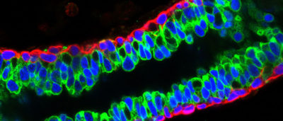 mapping-normal-breast-development-to-better-understand-cancer