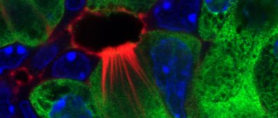 mysterious-tuft-cells-found-to-play-role-in-pancreatitis