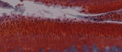 drug-combo-reverses-arthritis-in-rats