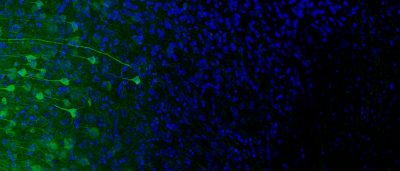 brain-biomarker-predicts-compulsive-drinking