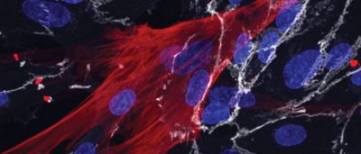 method-to-derive-blood-vessel-cells-from-skin-cells-suggests-ways-to-slow-aging