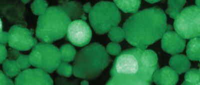 first-immune-evading-cells-created-to-treat-type-1-diabetes