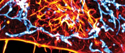 imaging-method-highlights-new-role-for-cellular-skeleton-protein