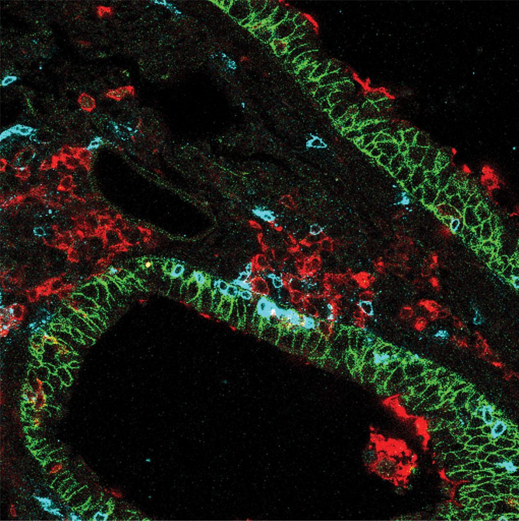 2020winter-resolution-microscopy
