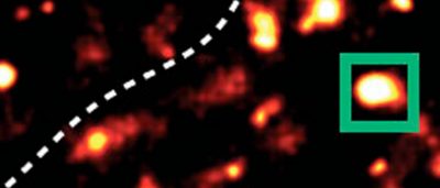 how-brain-cells-repair-their-dna-reveals-hot-spots-of-aging-and-disease