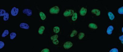 salk-scientists-reveal-role-of-genetic-switch-in-pigmentation-and-melanoma