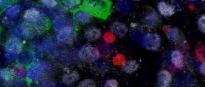 chimeric-tool-advanced-for-wide-range-of-regenerative-medicine-biomedical-research-applications