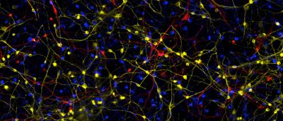salk-scientists-reveal-how-brain-cells-in-alzheimers-go-awry-lose-their-identity