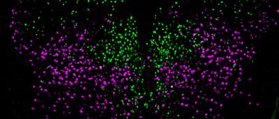 researchers-trace-spinal-neuron-family-tree
