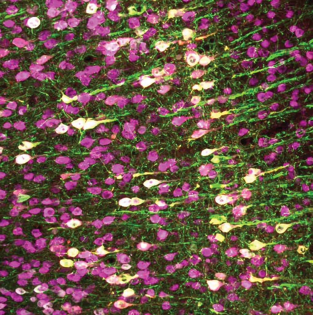 2022spring-resolution-microscopy