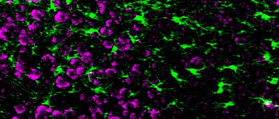 call-and-response-circuit-tells-neurons-when-to-grow-synapses