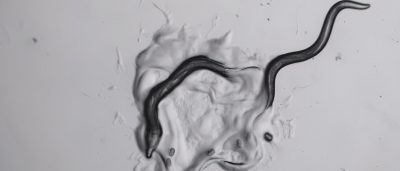 tiny-worms-make-complex-decisions-too