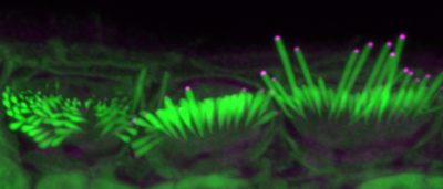 discovery-advances-the-potential-of-gene-therapy-to-restore-hearing-loss