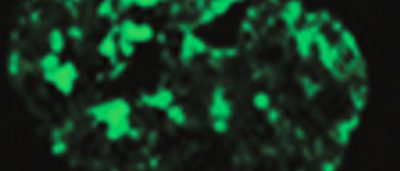 new-target-identified-for-treatment-of-premature-aging-disease
