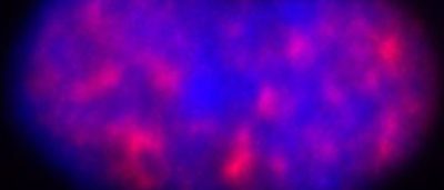 hair-raising-research-the-fascinating-link-between-the-immune-system-and-hair-growth