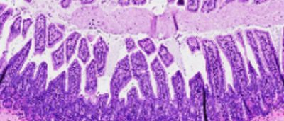 salk-scientists-develop-compound-that-reverses-gut-inflammation-in-mice