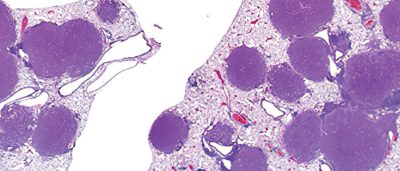 new-drug-combination-reduces-lung-tumors-in-mice