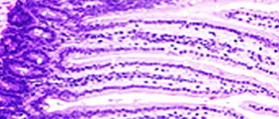 high-fat-diets-alter-gut-bacteria-boosting-colorectal-cancer-risk-in-mice